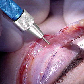 Chirurgie estetica si reconstructiva